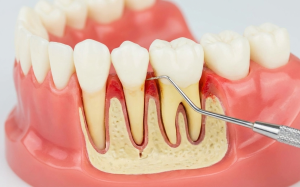 parodontologia brindisi