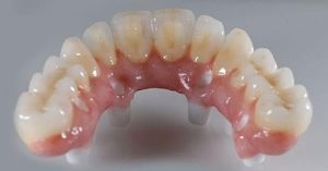 arcata dentale dental day 