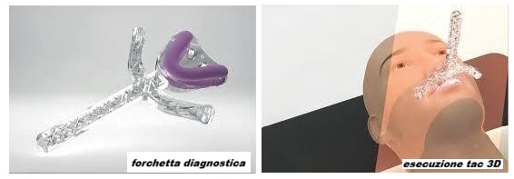 denti fissi san pietro vernotico dental day