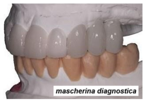 implantologia computer guidata san pietro vernotico