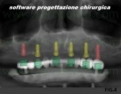 implantologia moderna dental day