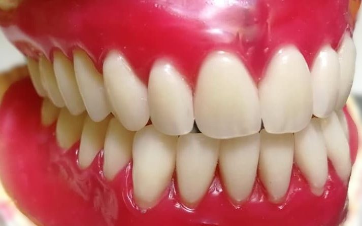 protesi dentale fissa dental day