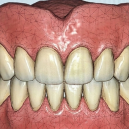 odontoiatria san pietro vernotico dental day
