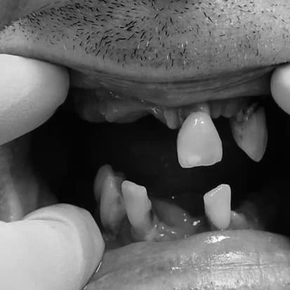 dental day medical carico immediato