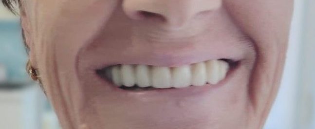 san pietro vernotico dentista