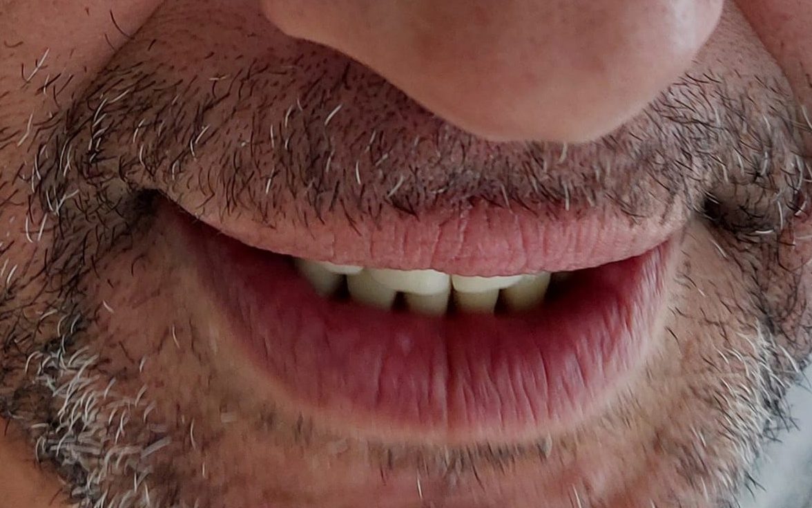 prebiodent dental day