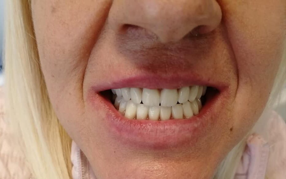 implantologia dental day