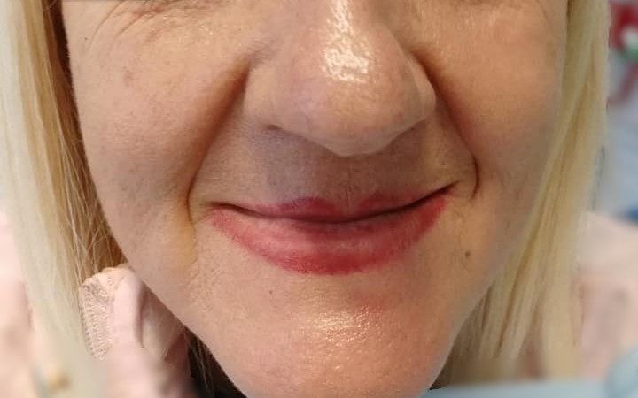 dental day medical implantologia