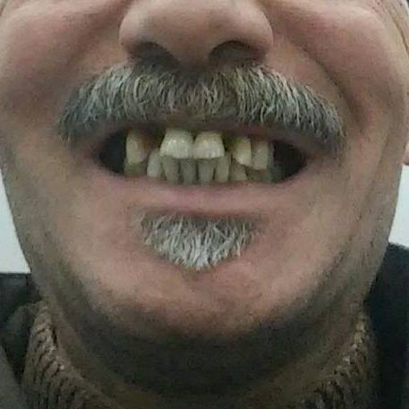 dental day medical parodontite