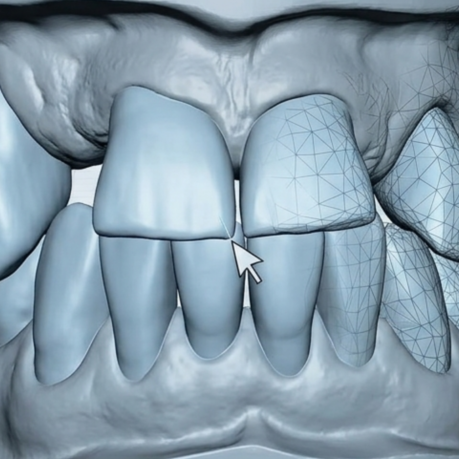 dental day medical prebiodent