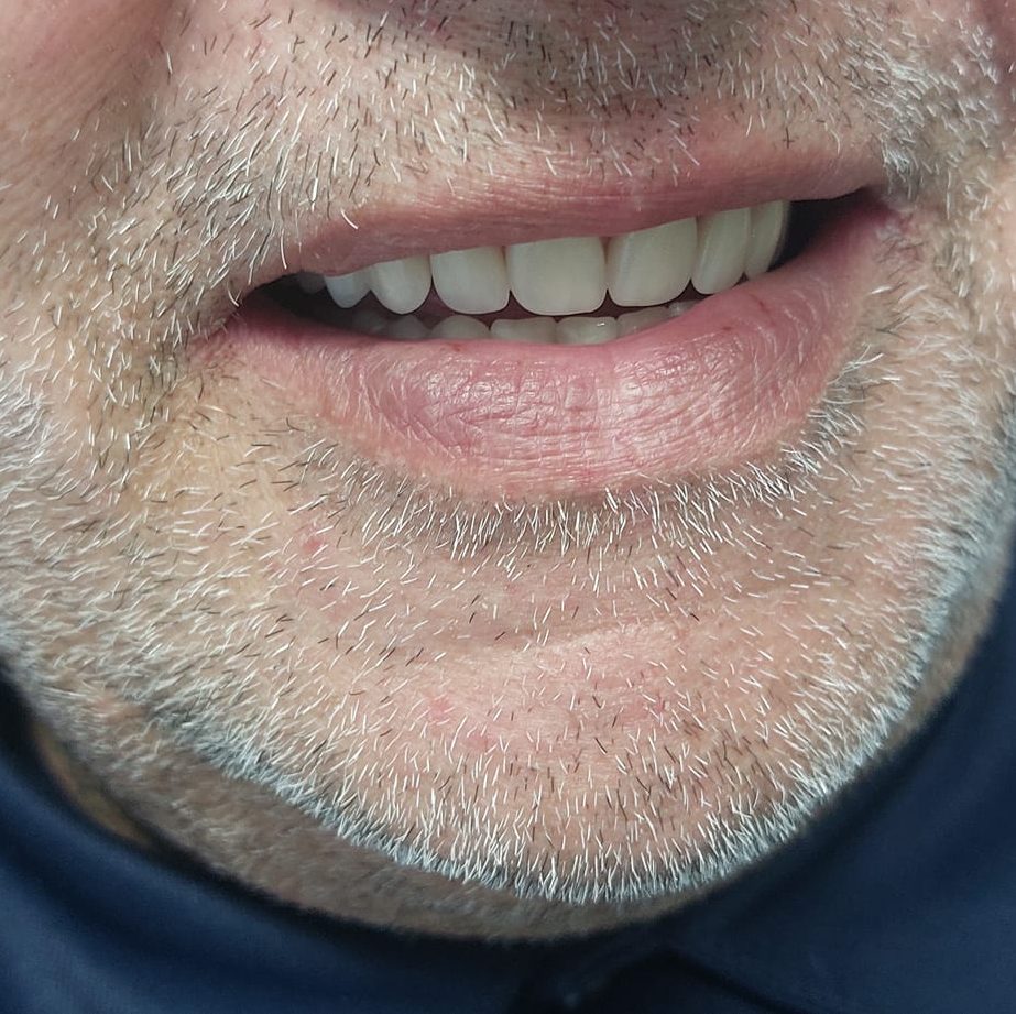 studio dentistico san pietro vernotico