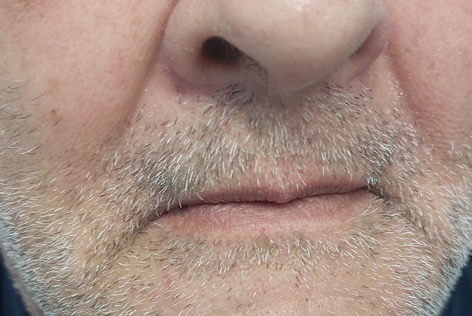 dental day san pietro vernotico