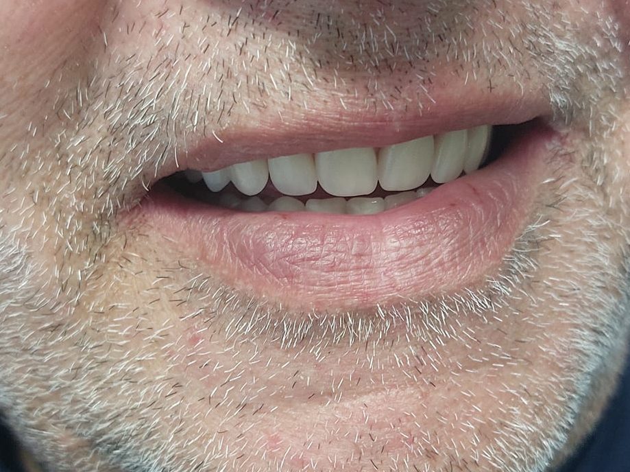 studio dentistico san pietro vernotico